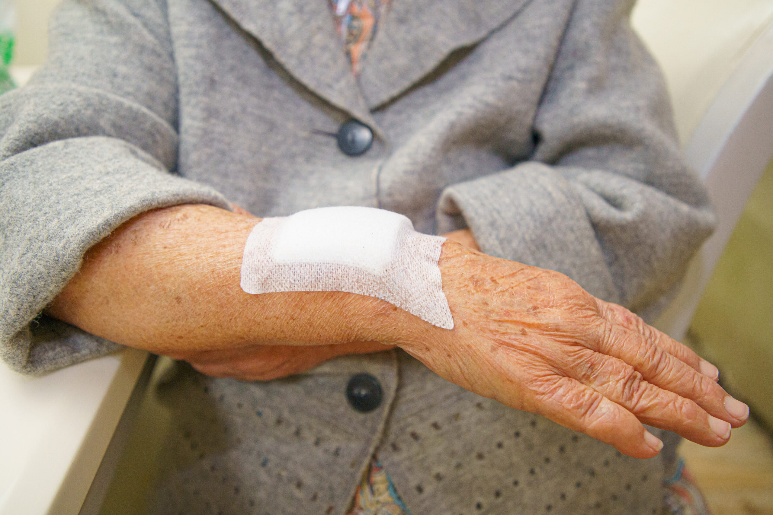 Understanding Elderly Skin Bruising | A Place for Mom